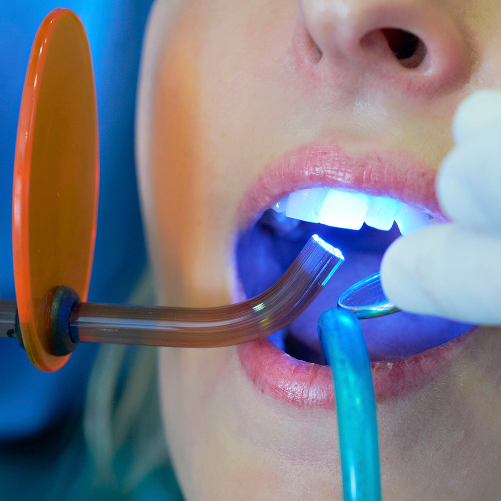 Resources on Dental fillings